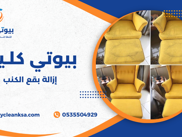 إزالة بقع الكنب